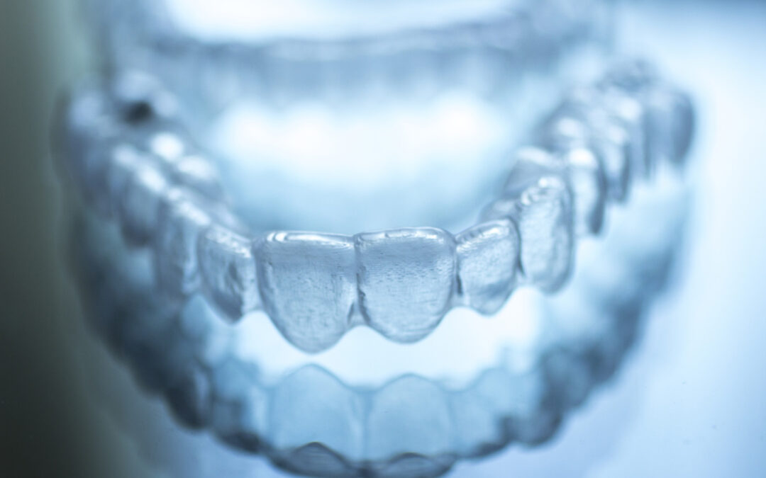 Before You Get Invisalign, Here’s What You Should Know